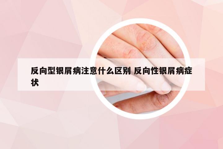反向型银屑病注意什么区别 反向性银屑病症状
