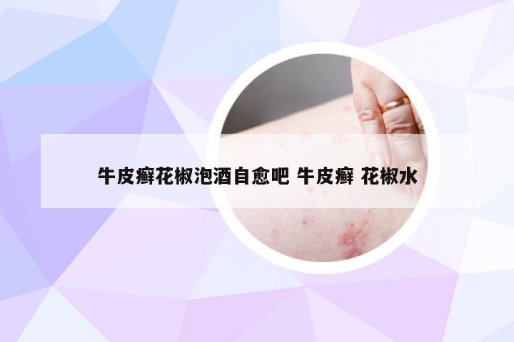 牛皮癣花椒泡酒自愈吧 牛皮癣 花椒水