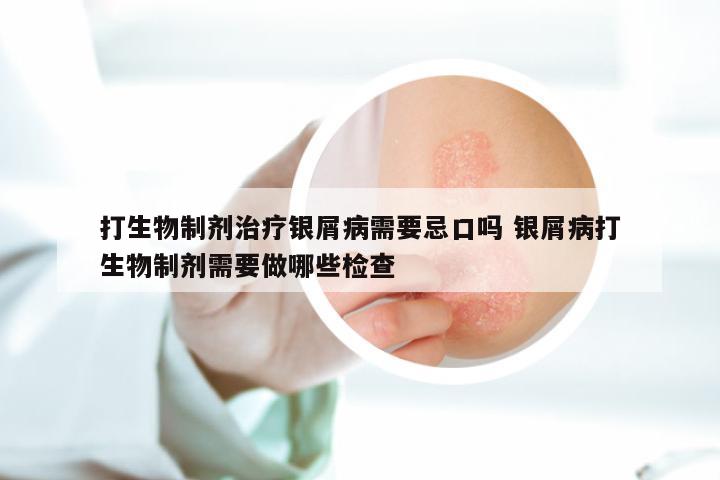 打生物制剂治疗银屑病需要忌口吗 银屑病打生物制剂需要做哪些检查