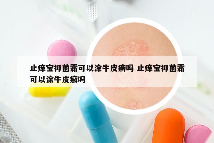 止痒宝抑菌霜可以涂牛皮癣吗 止痒宝抑菌霜可以涂牛皮癣吗