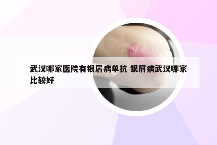 武汉哪家医院有银屑病单抗 银屑病武汉哪家比较好