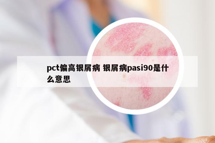 pct偏高银屑病 银屑病pasi90是什么意思