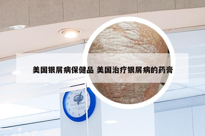 美国银屑病保健品 美国治疗银屑病的药膏