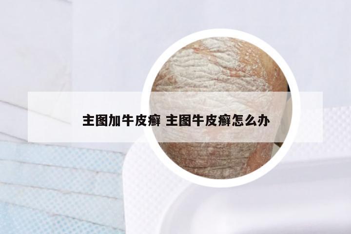主图加牛皮癣 主图牛皮癣怎么办