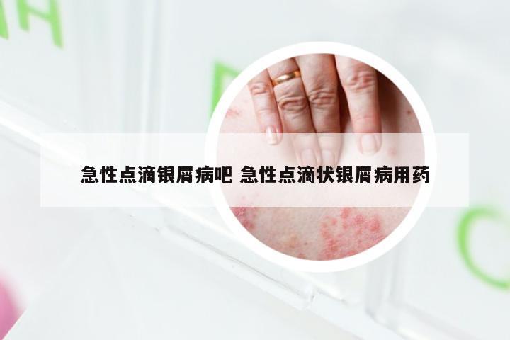 急性点滴银屑病吧 急性点滴状银屑病用药