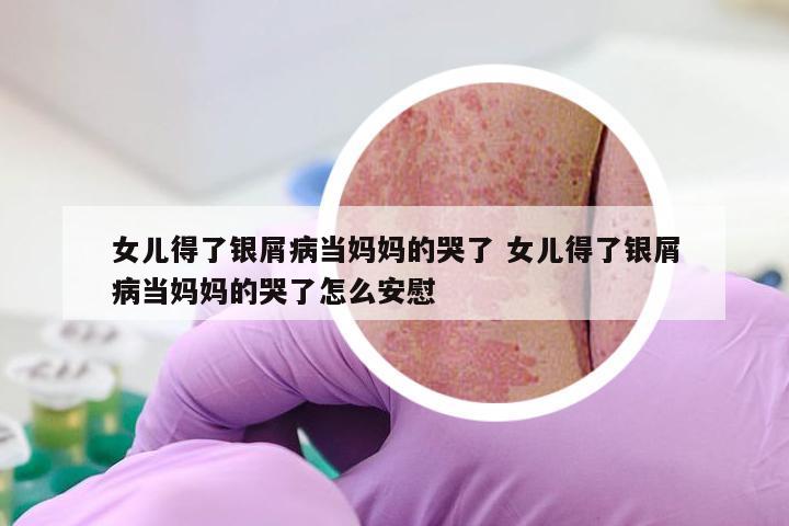 女儿得了银屑病当妈妈的哭了 女儿得了银屑病当妈妈的哭了怎么安慰