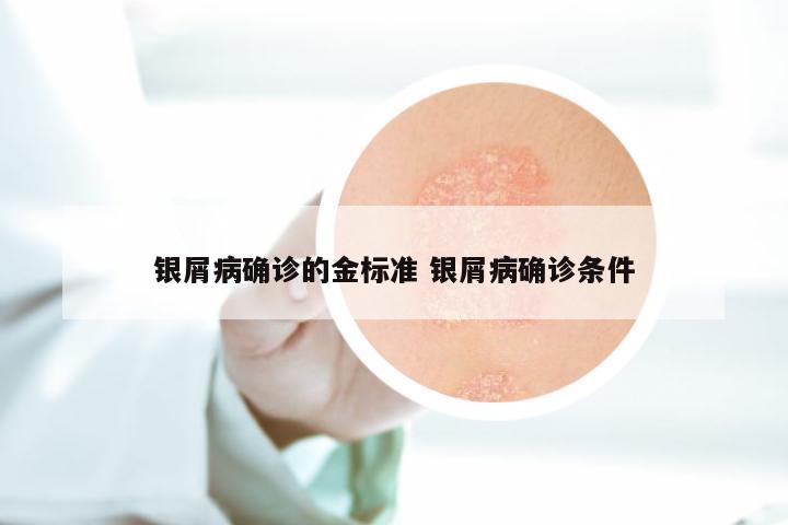 银屑病确诊的金标准 银屑病确诊条件