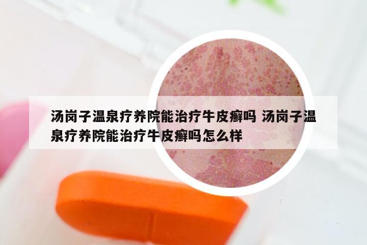 汤岗子温泉疗养院能治疗牛皮癣吗 汤岗子温泉疗养院能治疗牛皮癣吗怎么样