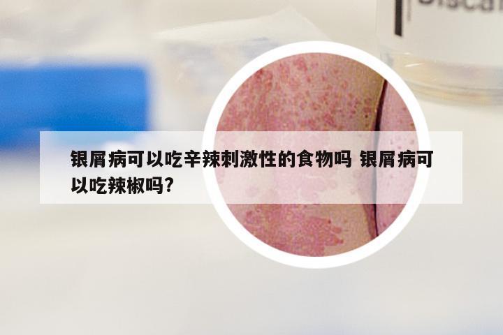 银屑病可以吃辛辣刺激性的食物吗 银屑病可以吃辣椒吗?