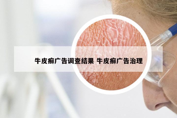 牛皮癣广告调查结果 牛皮癣广告治理
