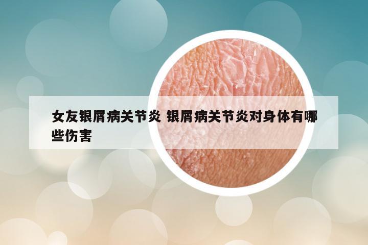 女友银屑病关节炎 银屑病关节炎对身体有哪些伤害