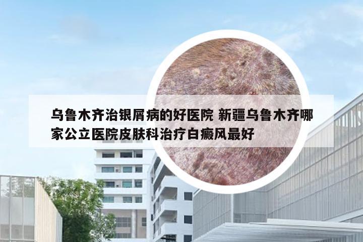 乌鲁木齐治银屑病的好医院 新疆乌鲁木齐哪家公立医院皮肤科治疗白癜风最好