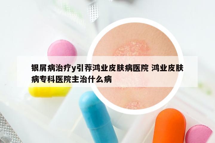银屑病治疗y引荐鸿业皮肤病医院 鸿业皮肤病专科医院主治什么病