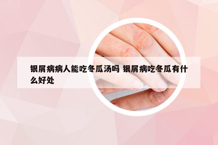 银屑病病人能吃冬瓜汤吗 银屑病吃冬瓜有什么好处