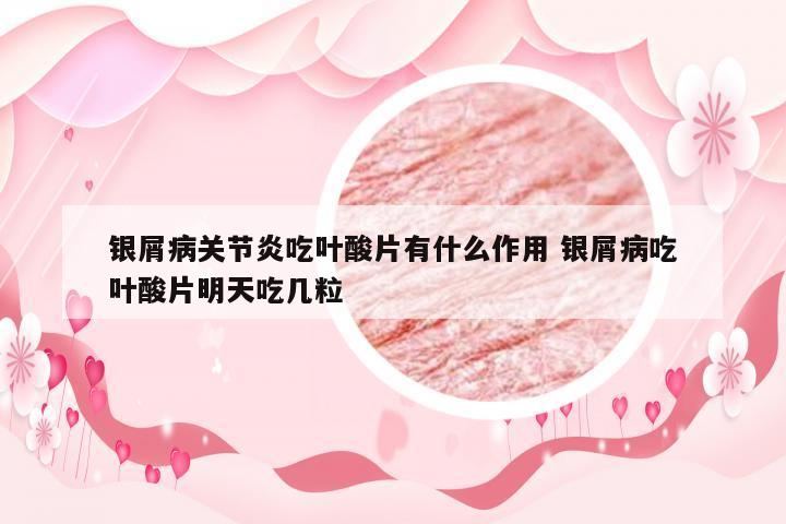 银屑病关节炎吃叶酸片有什么作用 银屑病吃叶酸片明天吃几粒