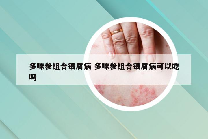 多味参组合银屑病 多味参组合银屑病可以吃吗