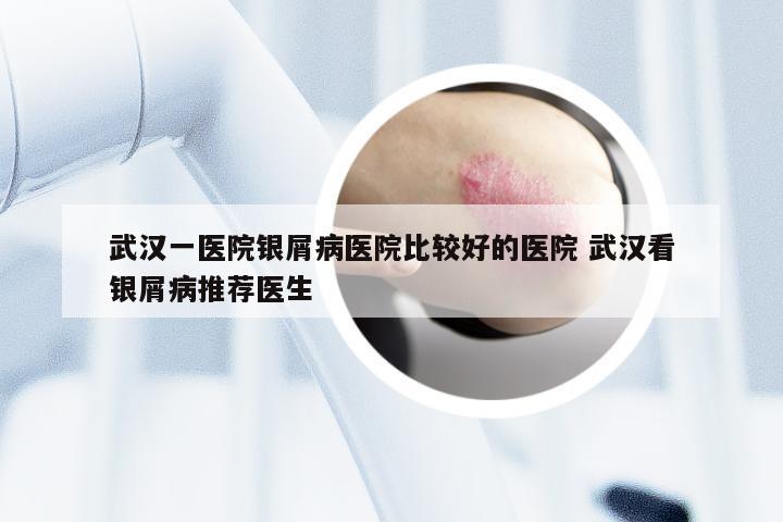 武汉一医院银屑病医院比较好的医院 武汉看银屑病推荐医生