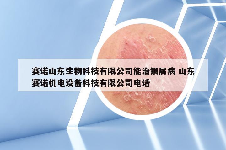 赛诺山东生物科技有限公司能治银屑病 山东赛诺机电设备科技有限公司电话