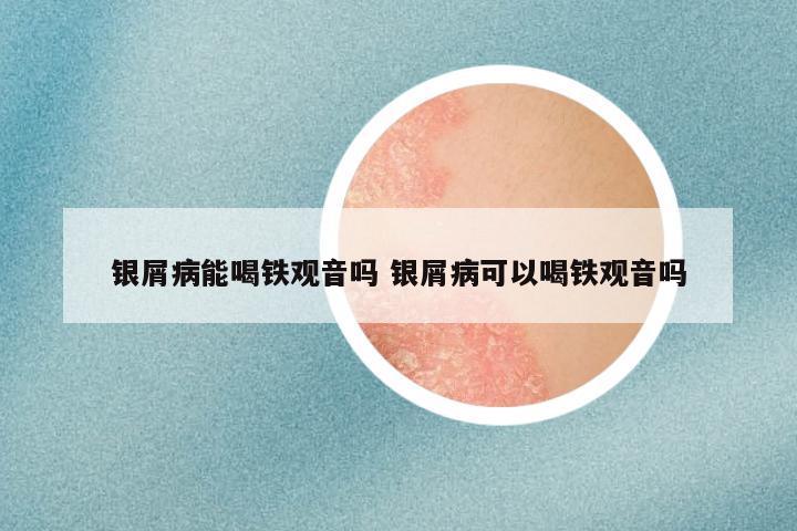 银屑病能喝铁观音吗 银屑病可以喝铁观音吗