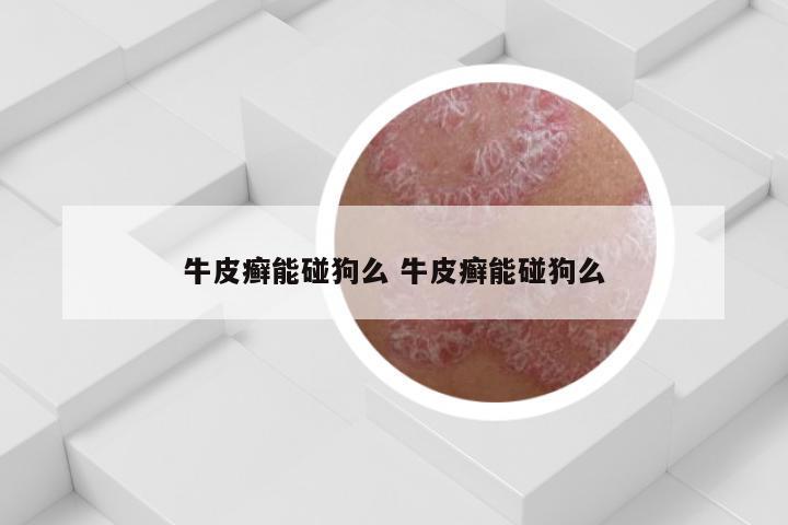 牛皮癣能碰狗么 牛皮癣能碰狗么