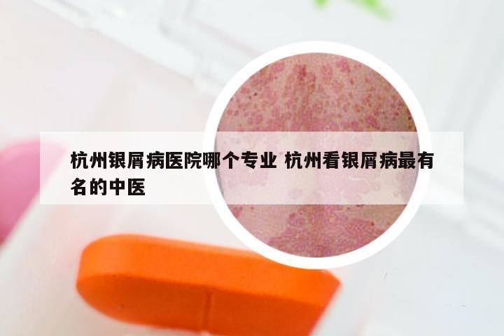 杭州银屑病医院哪个专业 杭州看银屑病最有名的中医