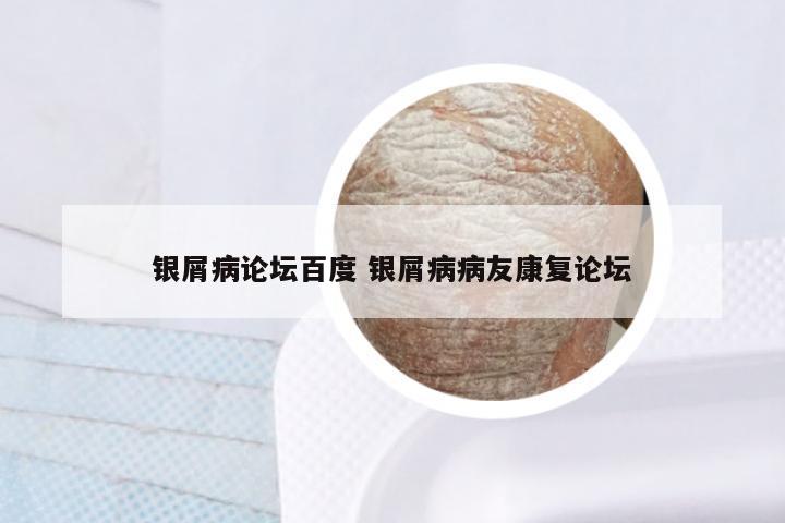 银屑病论坛百度 银屑病病友康复论坛