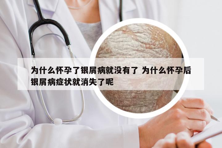 为什么怀孕了银屑病就没有了 为什么怀孕后银屑病症状就消失了呢