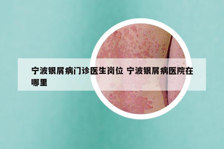 宁波银屑病门诊医生岗位 宁波银屑病医院在哪里