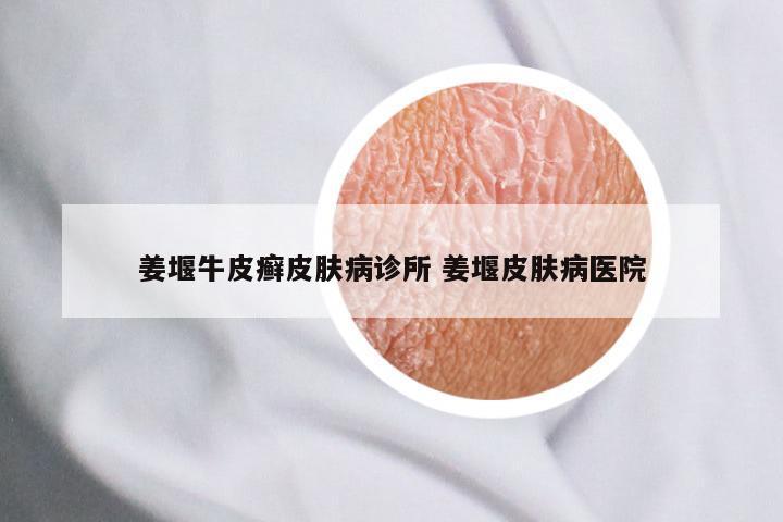 姜堰牛皮癣皮肤病诊所 姜堰皮肤病医院