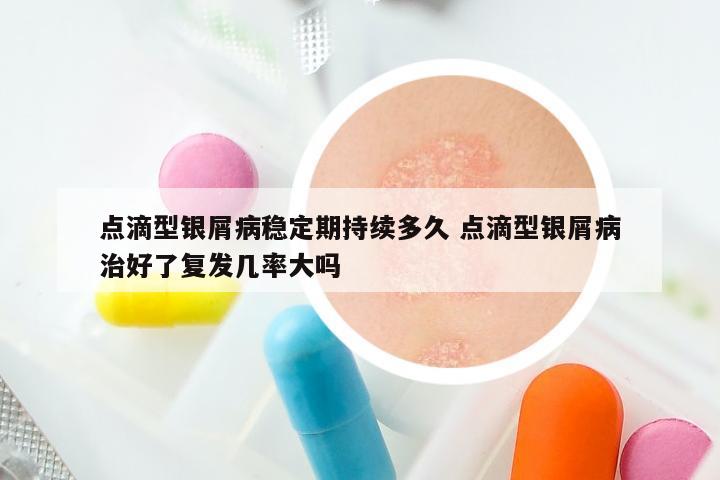 点滴型银屑病稳定期持续多久 点滴型银屑病治好了复发几率大吗