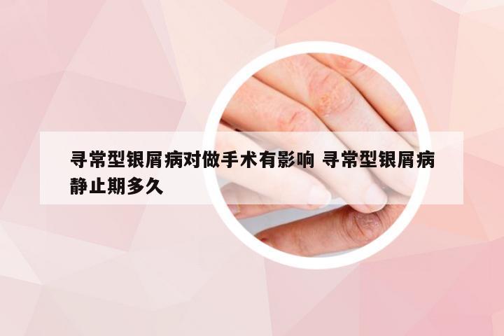 寻常型银屑病对做手术有影响 寻常型银屑病静止期多久