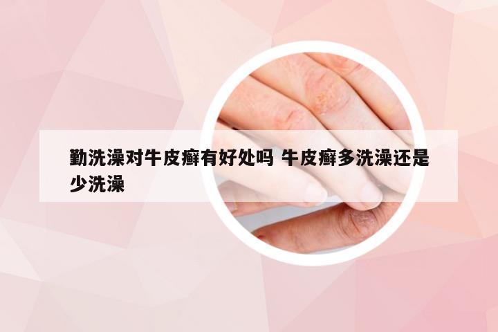勤洗澡对牛皮癣有好处吗 牛皮癣多洗澡还是少洗澡
