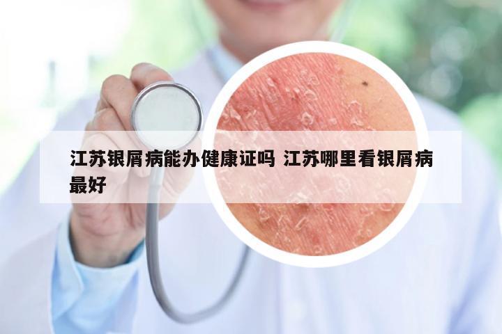江苏银屑病能办健康证吗 江苏哪里看银屑病最好