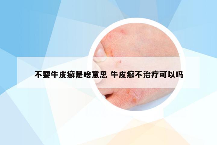 不要牛皮癣是啥意思 牛皮癣不治疗可以吗