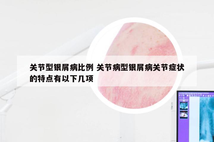 关节型银屑病比例 关节病型银屑病关节症状的特点有以下几项