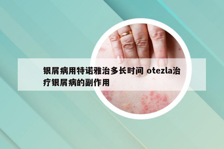 银屑病用特诺雅治多长时间 otezla治疗银屑病的副作用