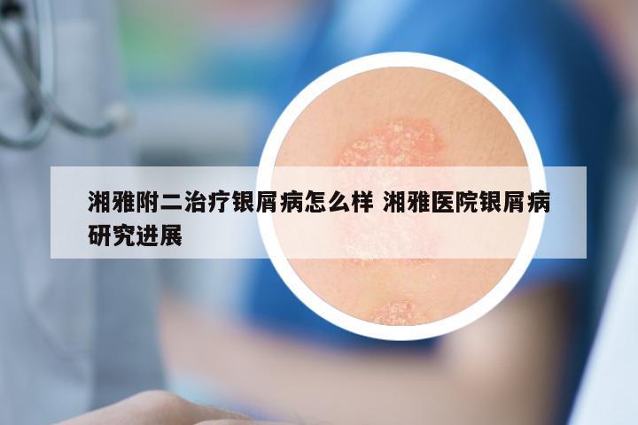 湘雅附二治疗银屑病怎么样 湘雅医院银屑病研究进展