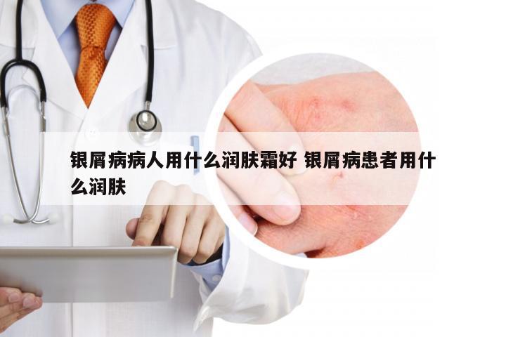 银屑病病人用什么润肤霜好 银屑病患者用什么润肤