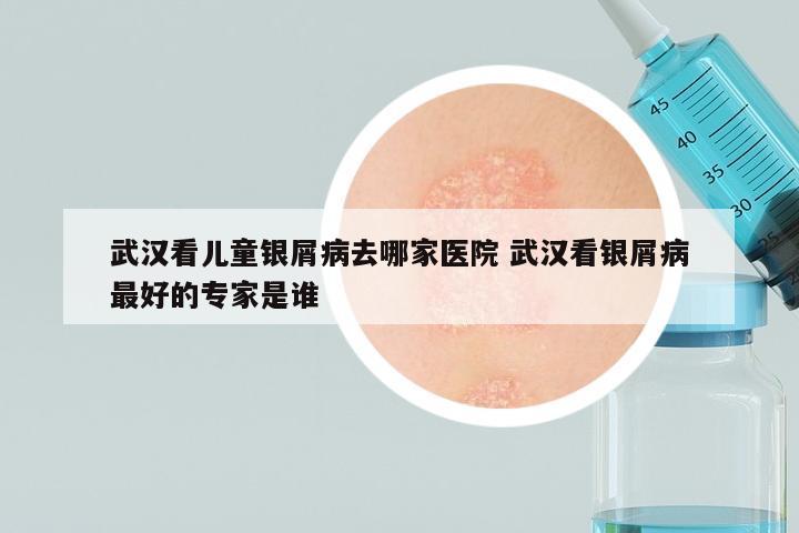 武汉看儿童银屑病去哪家医院 武汉看银屑病最好的专家是谁