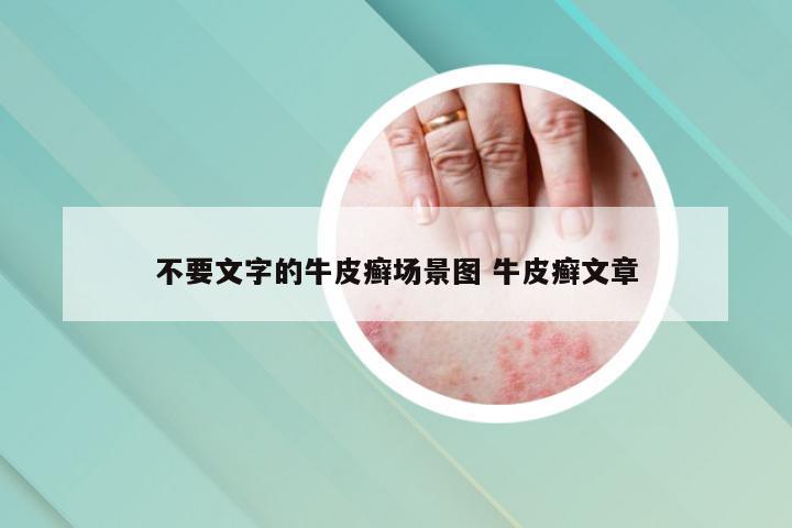 不要文字的牛皮癣场景图 牛皮癣文章