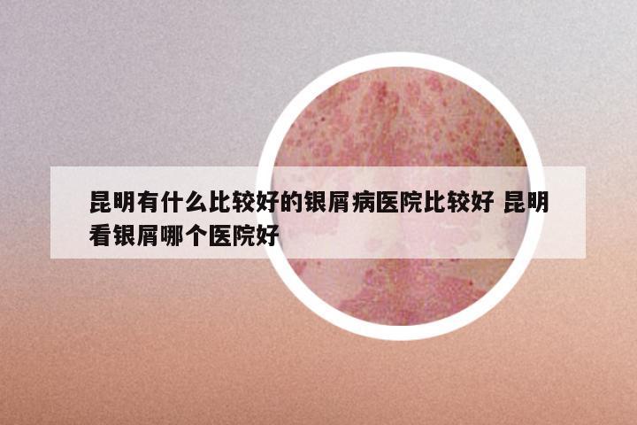 昆明有什么比较好的银屑病医院比较好 昆明看银屑哪个医院好