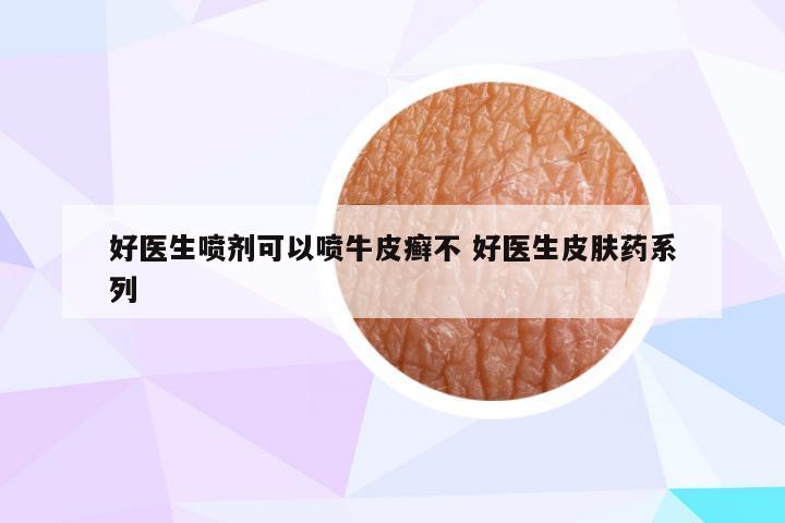好医生喷剂可以喷牛皮癣不 好医生皮肤药系列
