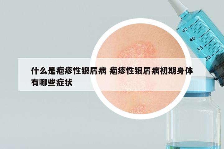 什么是疱疹性银屑病 疱疹性银屑病初期身体有哪些症状