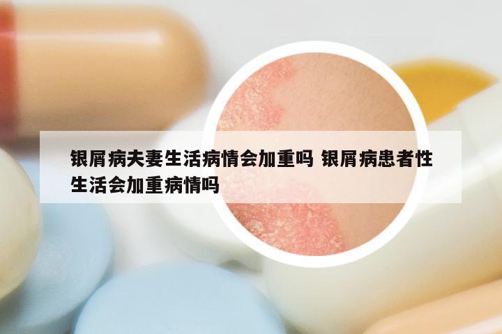银屑病夫妻生活病情会加重吗 银屑病患者性生活会加重病情吗