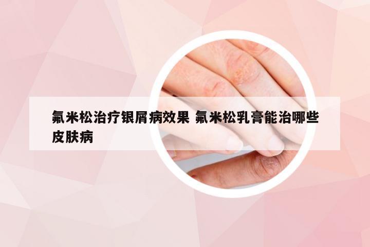 氟米松治疗银屑病效果 氟米松乳膏能治哪些皮肤病