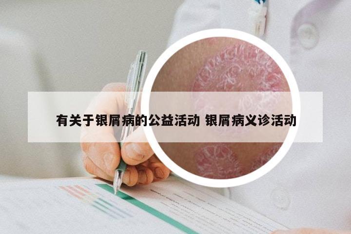 有关于银屑病的公益活动 银屑病义诊活动