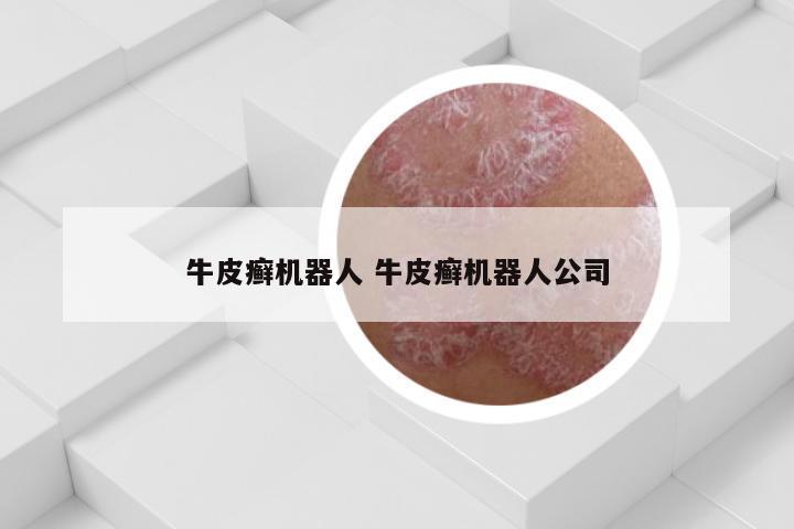 牛皮癣机器人 牛皮癣机器人公司