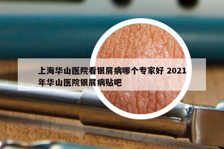 上海华山医院看银屑病哪个专家好 2021年华山医院银屑病贴吧