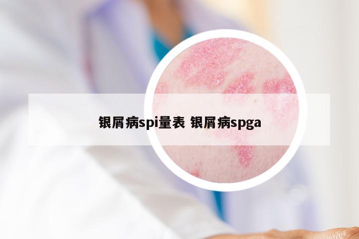 银屑病spi量表 银屑病spga