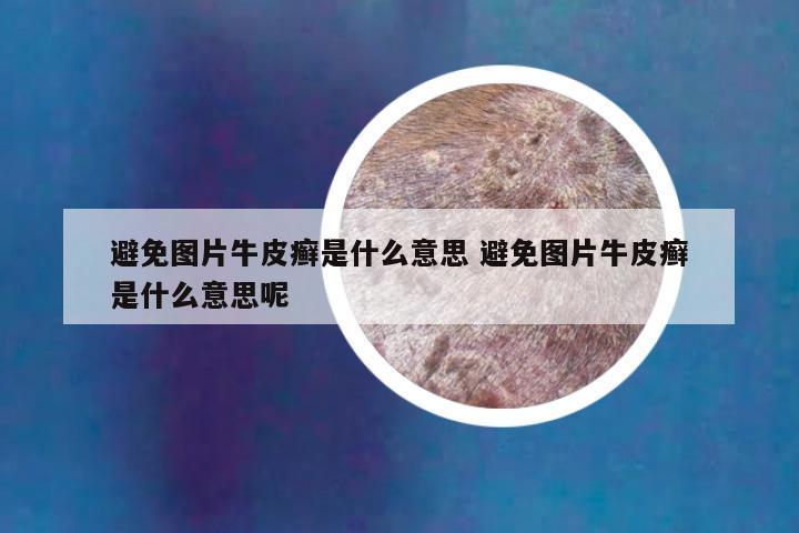避免图片牛皮癣是什么意思 避免图片牛皮癣是什么意思呢